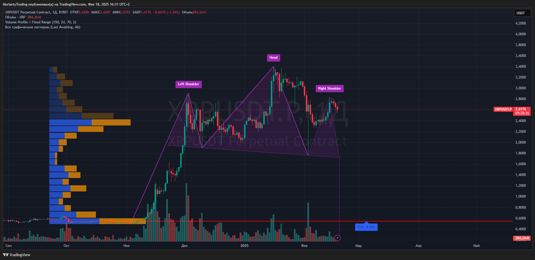 BYBIT:XRPUSDT.P Chart Image by MoriartyTrading