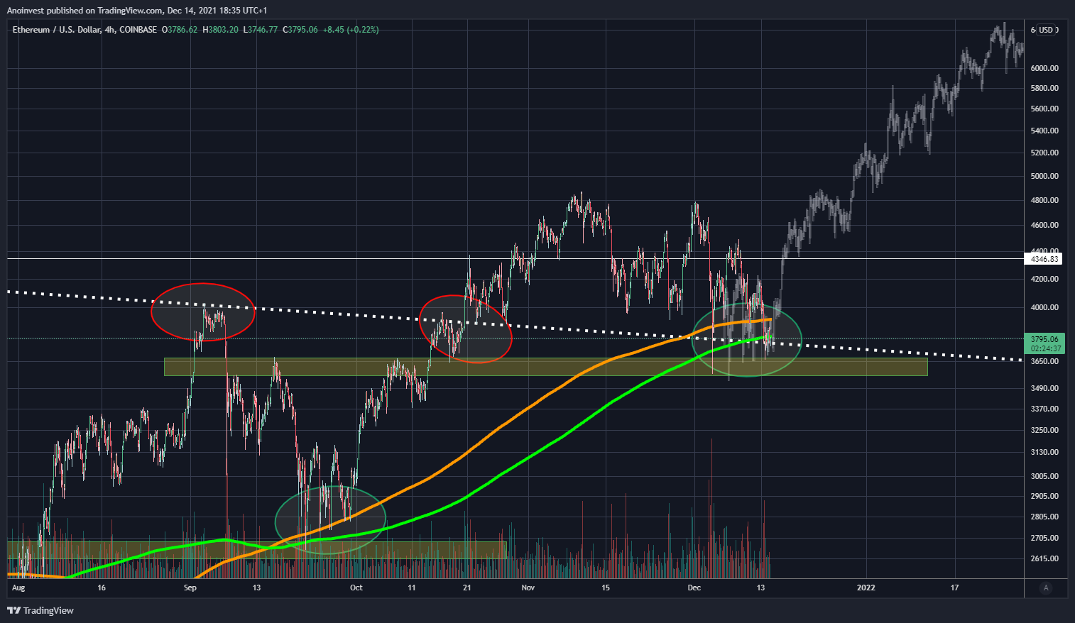 COINBASE:ETHUSD Chart Image by Anoinvest