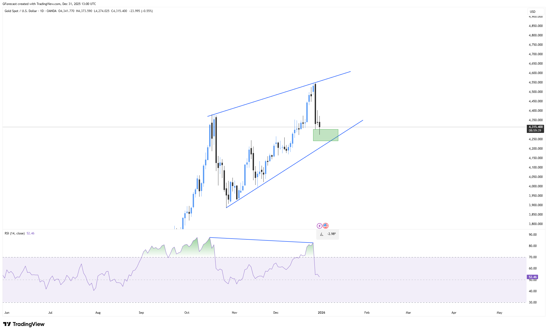 OANDA:XAUUSD Chart Image by GForecast