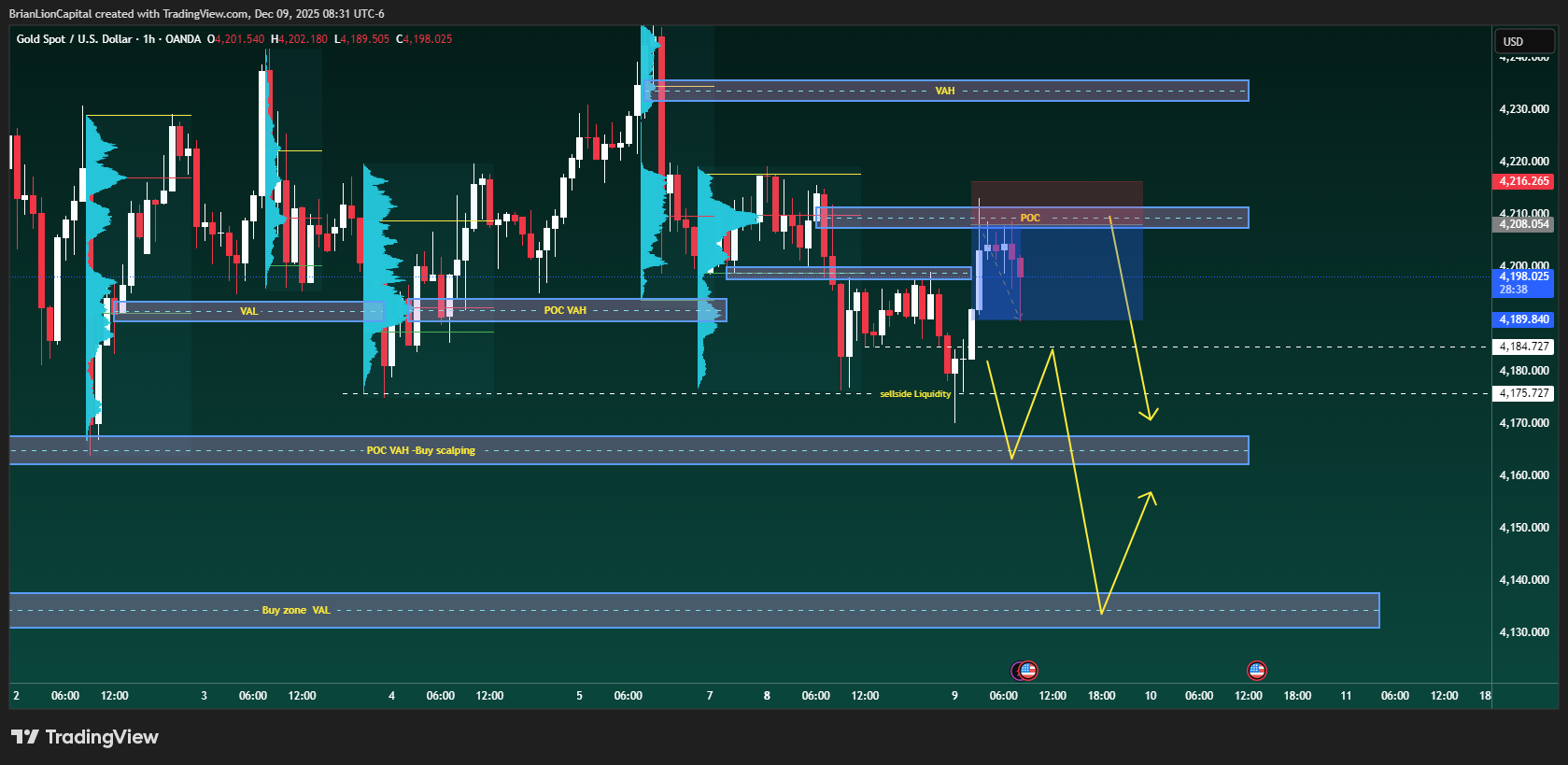 OANDA:XAUUSD Chart Image by BrianLionCapital