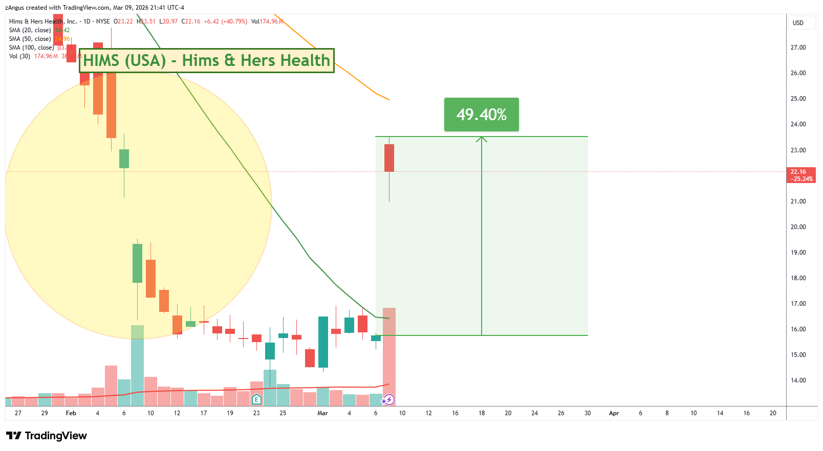 NYSE:HIMS Chart Image by zAngus