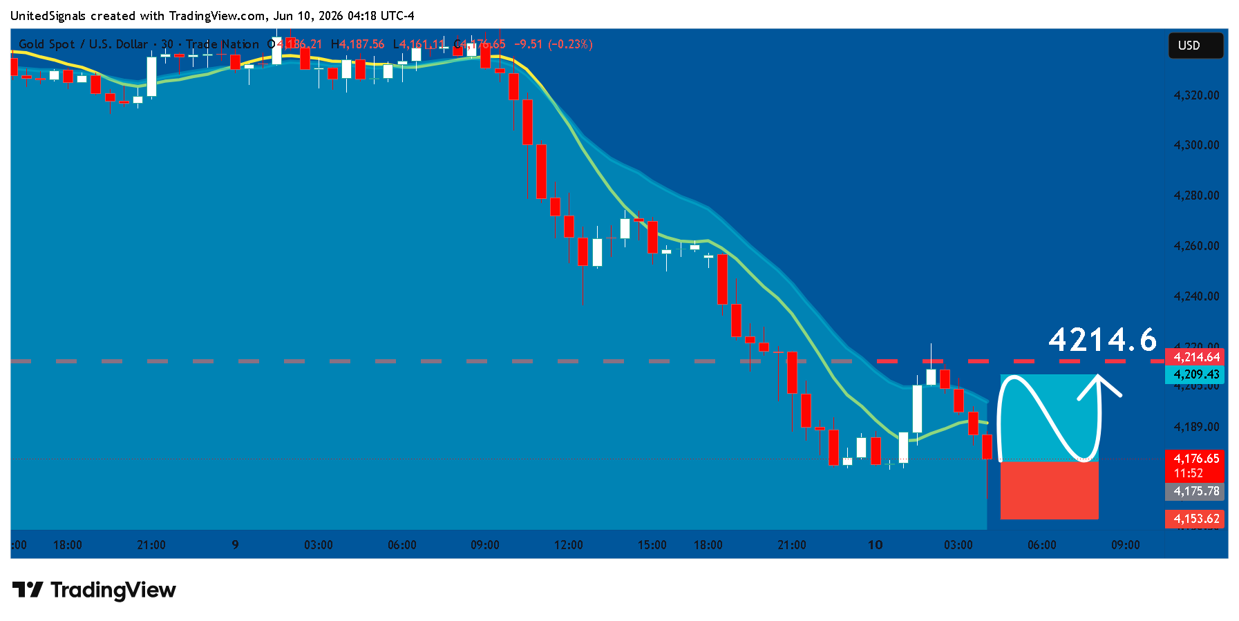 TRADENATION:XAUUSD Chart Image by UnitedSignals