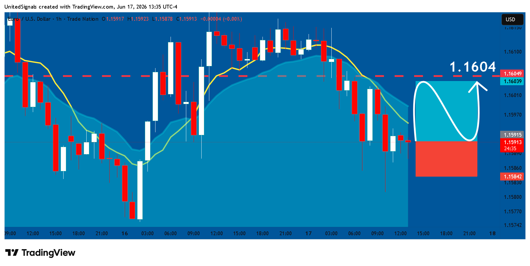 TRADENATION:EURUSD Chart Image by UnitedSignals