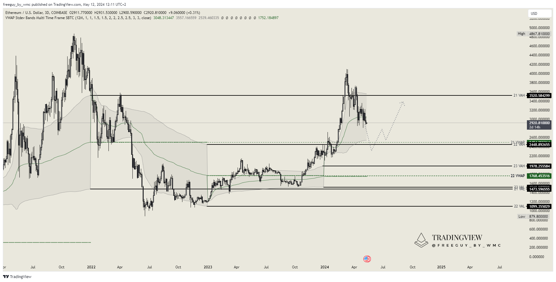 COINBASE:ETHUSD Chart Image by freeguy_by_wmc