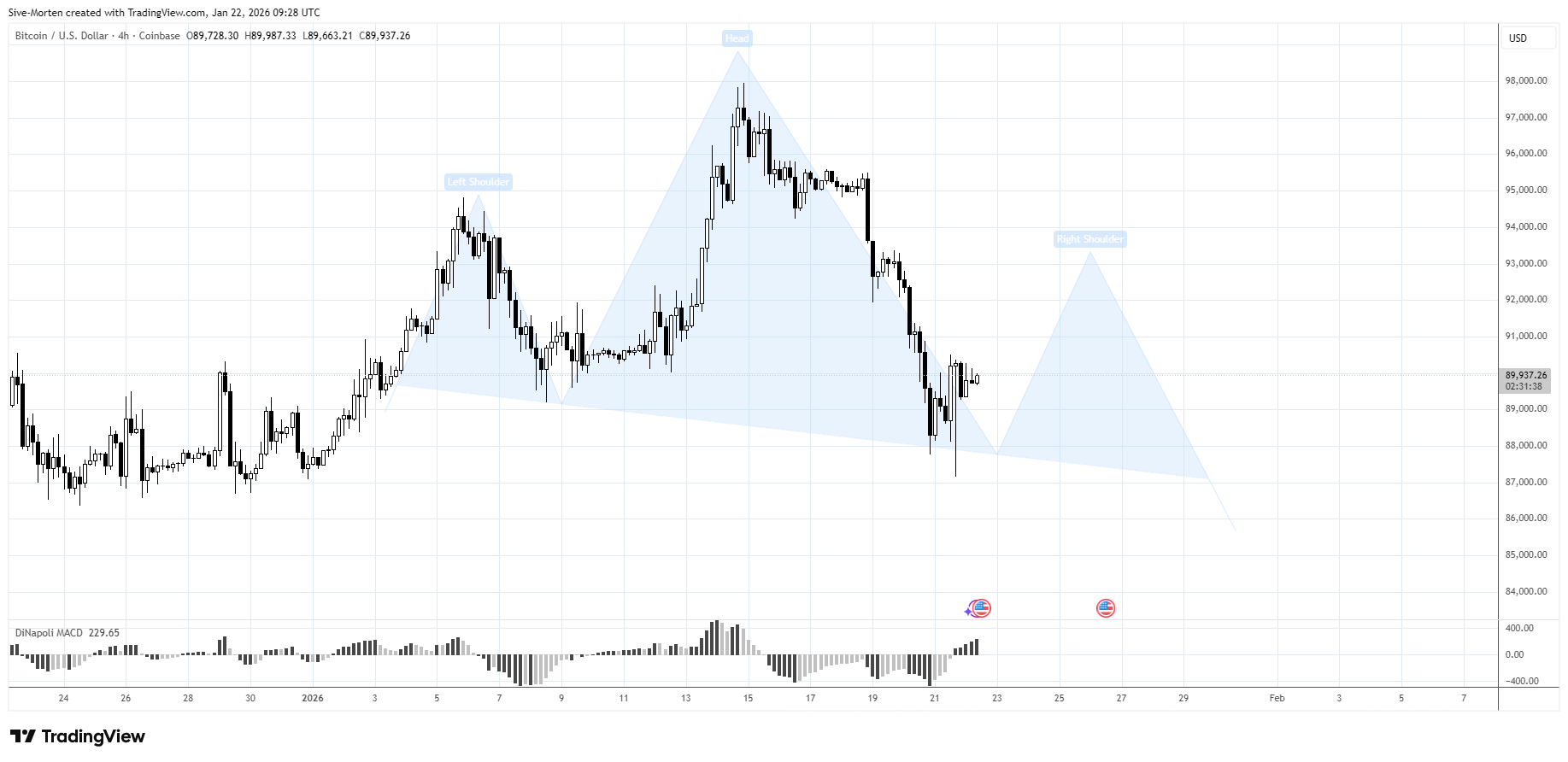 COINBASE:BTCUSD Chart Image by Sive-Morten