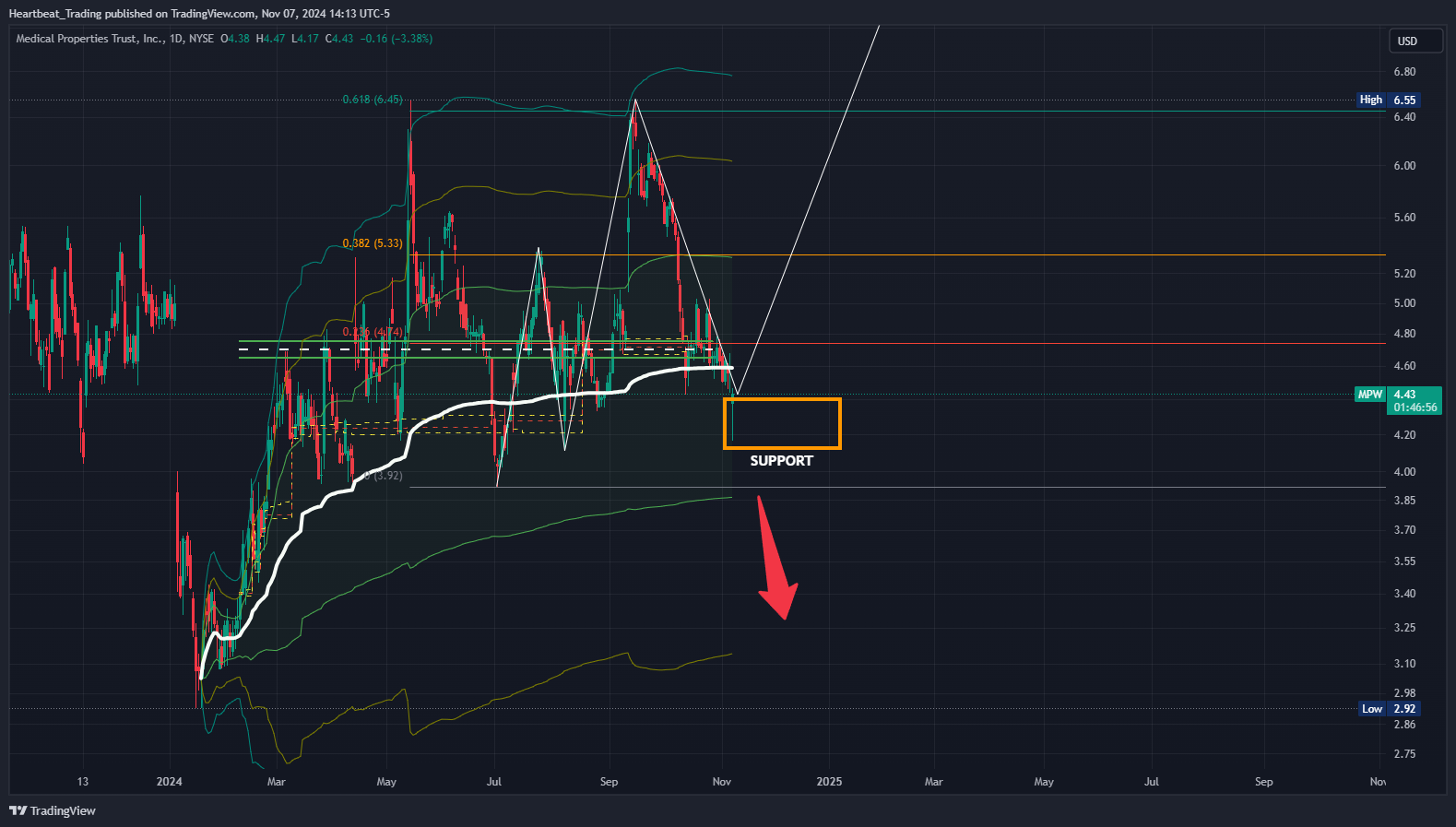 BATS:MPW Imagen del gráfico de Heartbeat_Trading