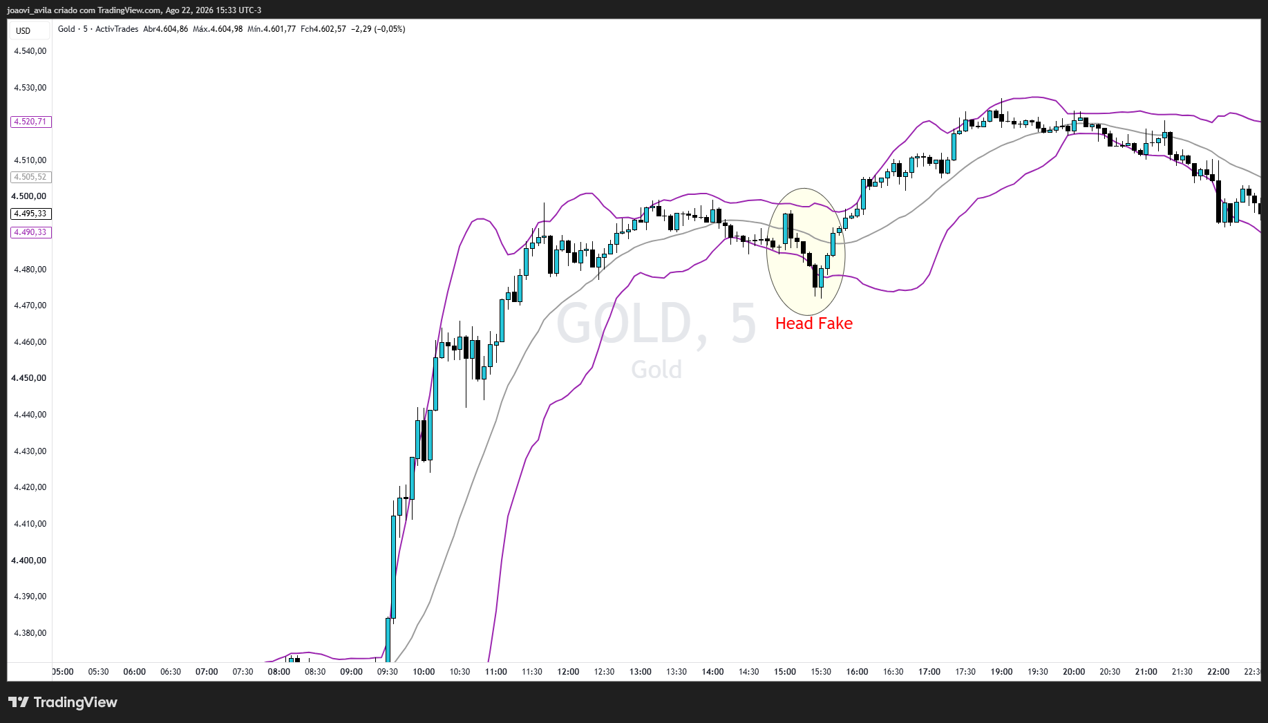 ACTIVTRADES:GOLD Chart Image by joaovi_avila