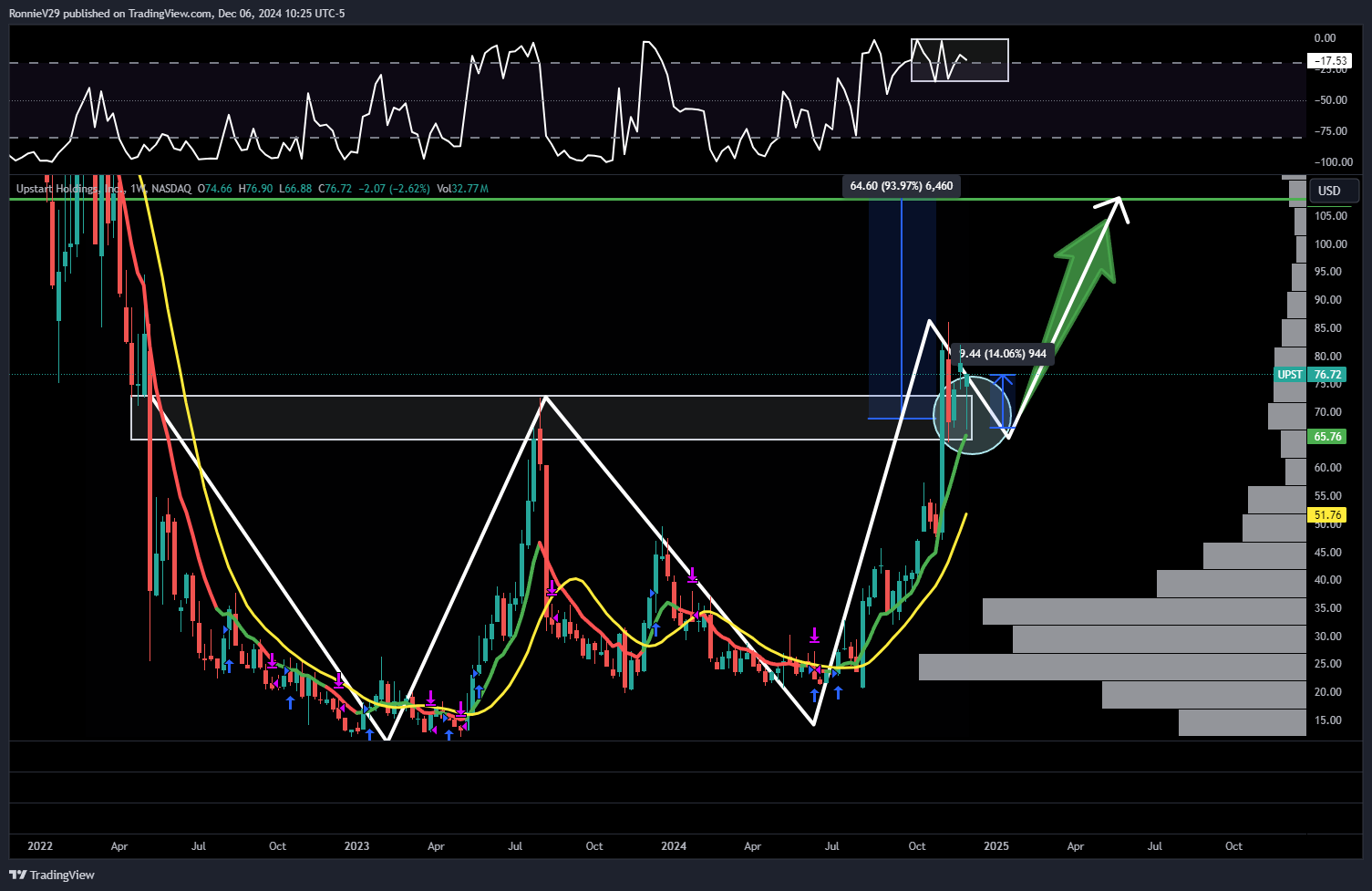 NASDAQ:UPST Chart Image by RonnieV29