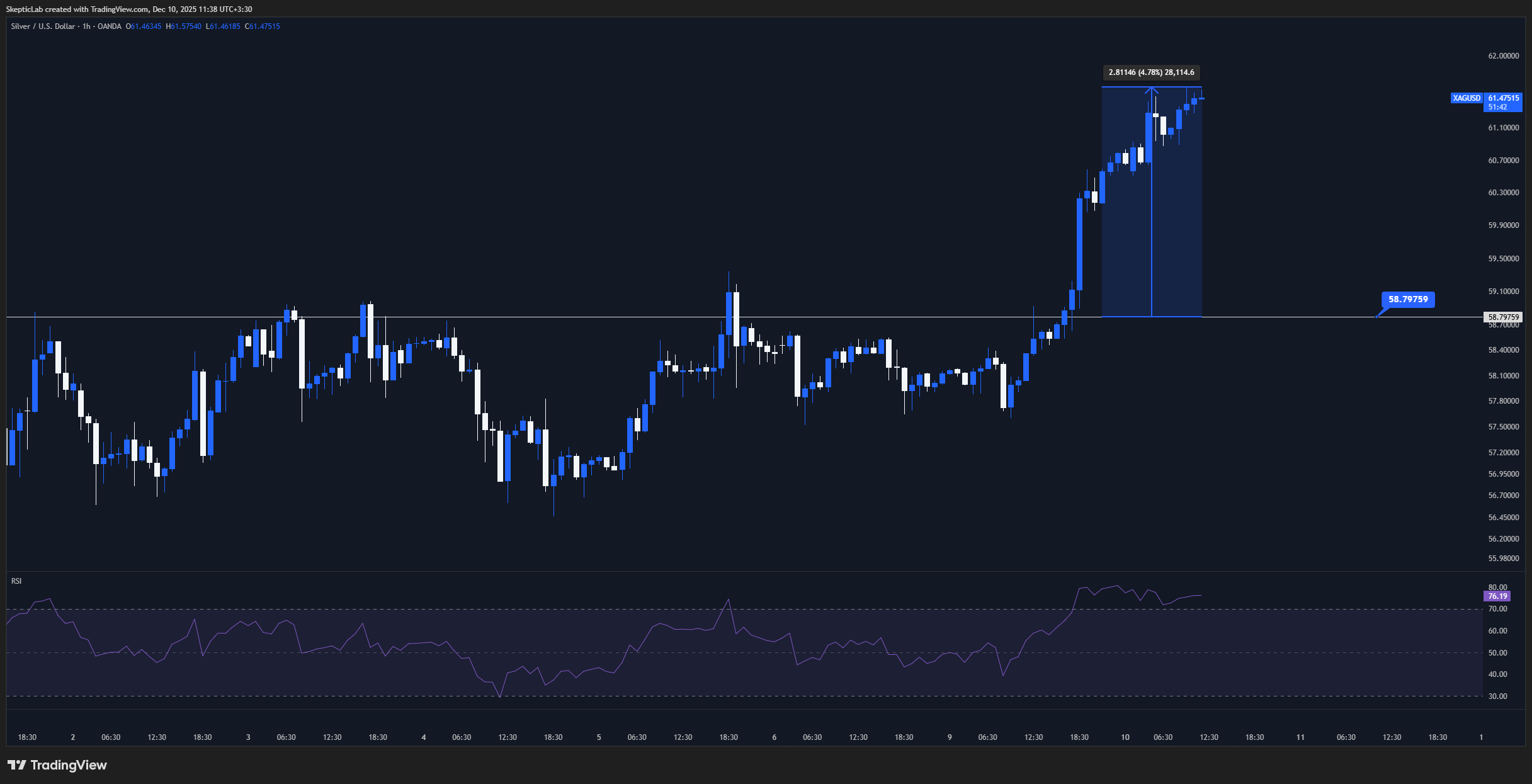OANDA:XAGUSD Chart Image by SkepticLab