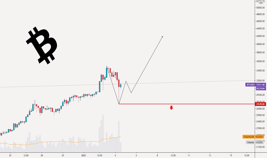 #BITCOIN Short Term