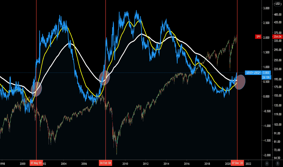 Bond Yields point to recession....or this time it's different?