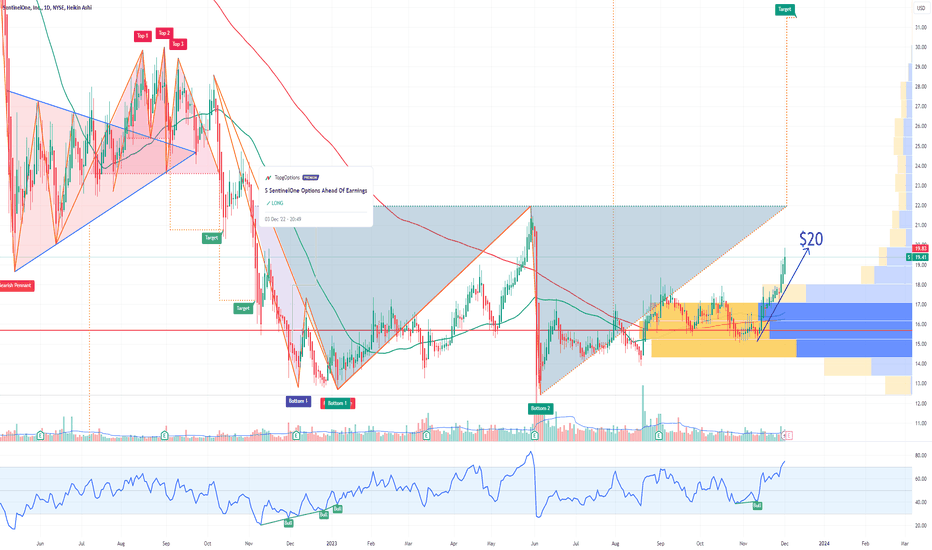 S SentinelOne Options Ahead of Earnings
